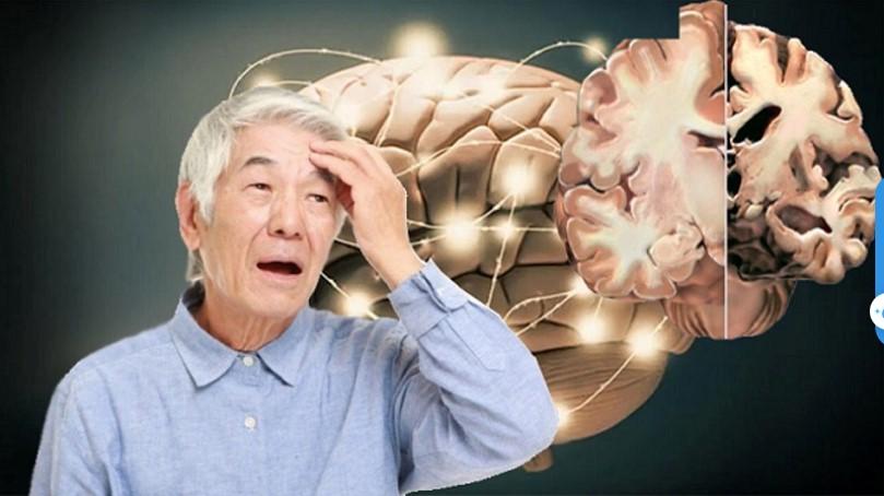 chăm sóc Alzheimer